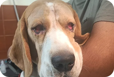 Eyelid Abnormalities